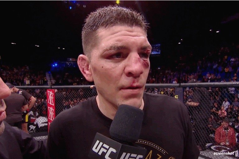 Nick-Diaz-768x512