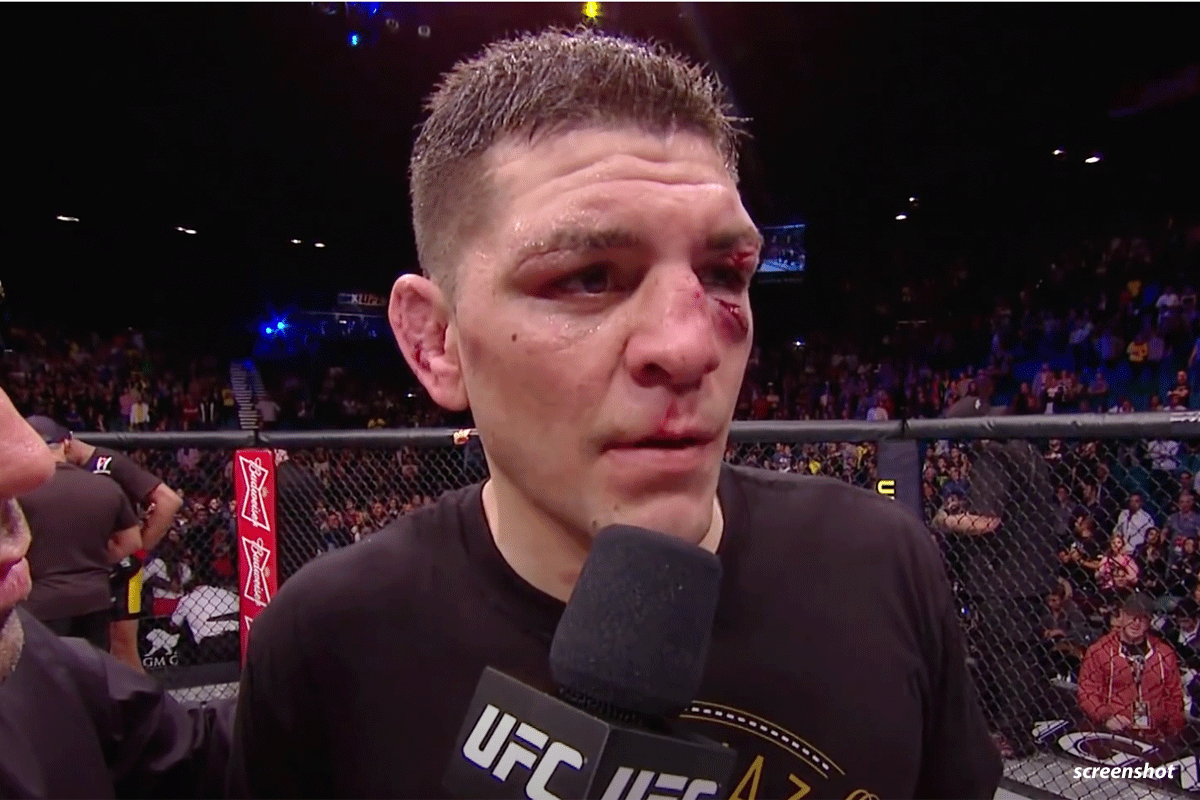 Nick-Diaz
