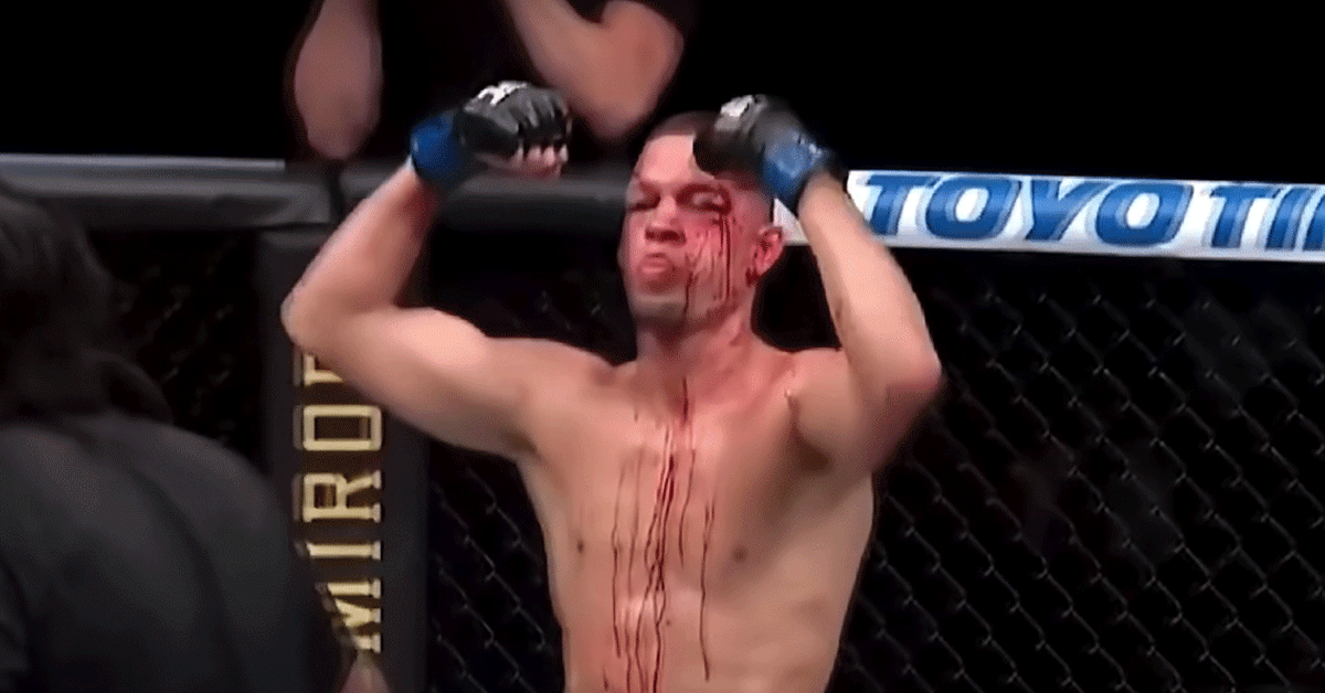 Nate-Diaz