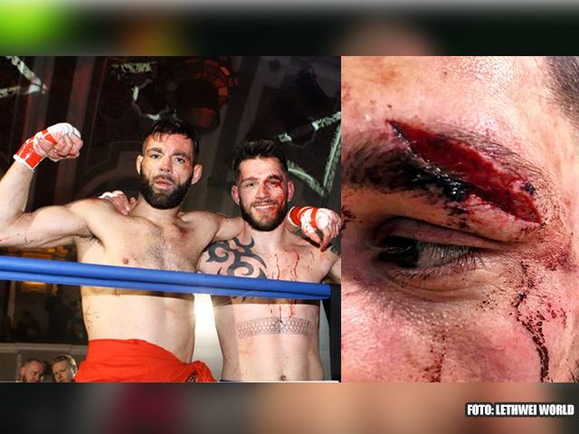 Lethwei