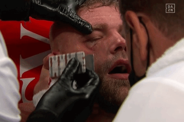 billy-Joe-saunders-768x512