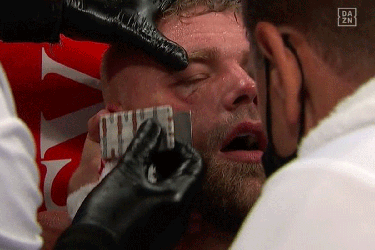 billy-Joe-saunders