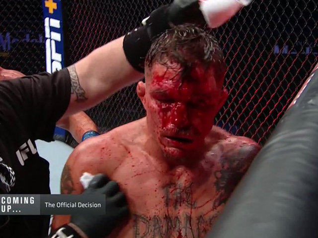 darren-elkins