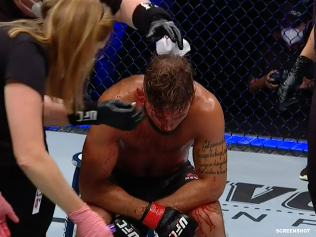 ufc-vechter