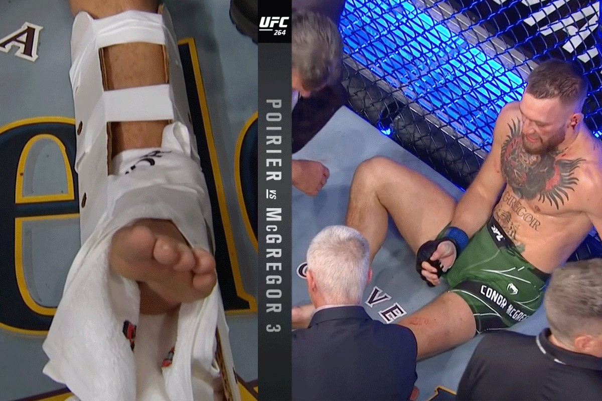 Conor-McGregor-breekt-enkel