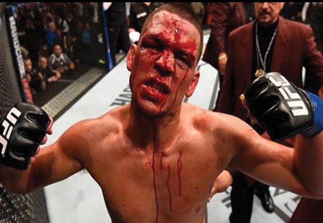 nate-diaz-63d012bed10c3