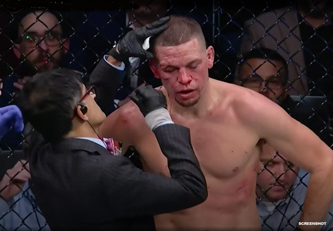 nate-diaz-63d02069d7537