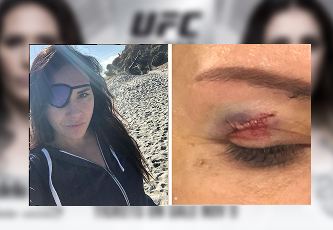 zingano-63d023d920fb8